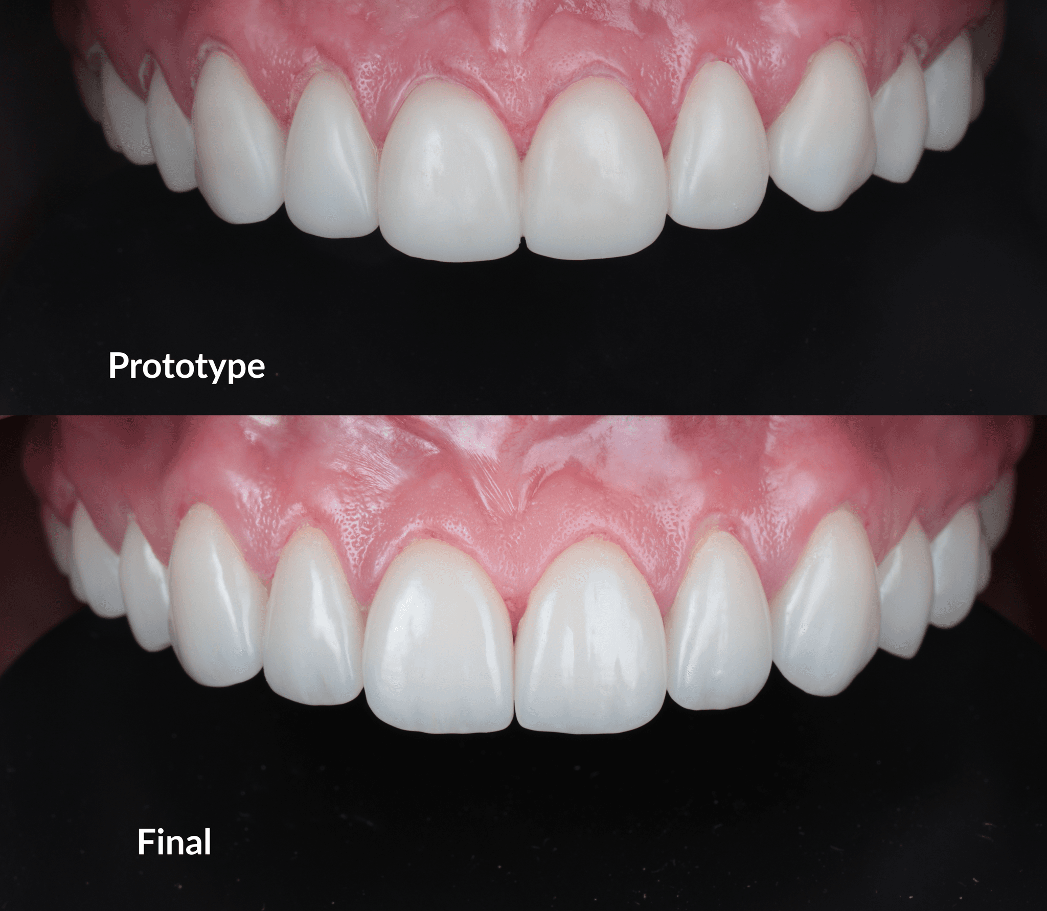 Prototype