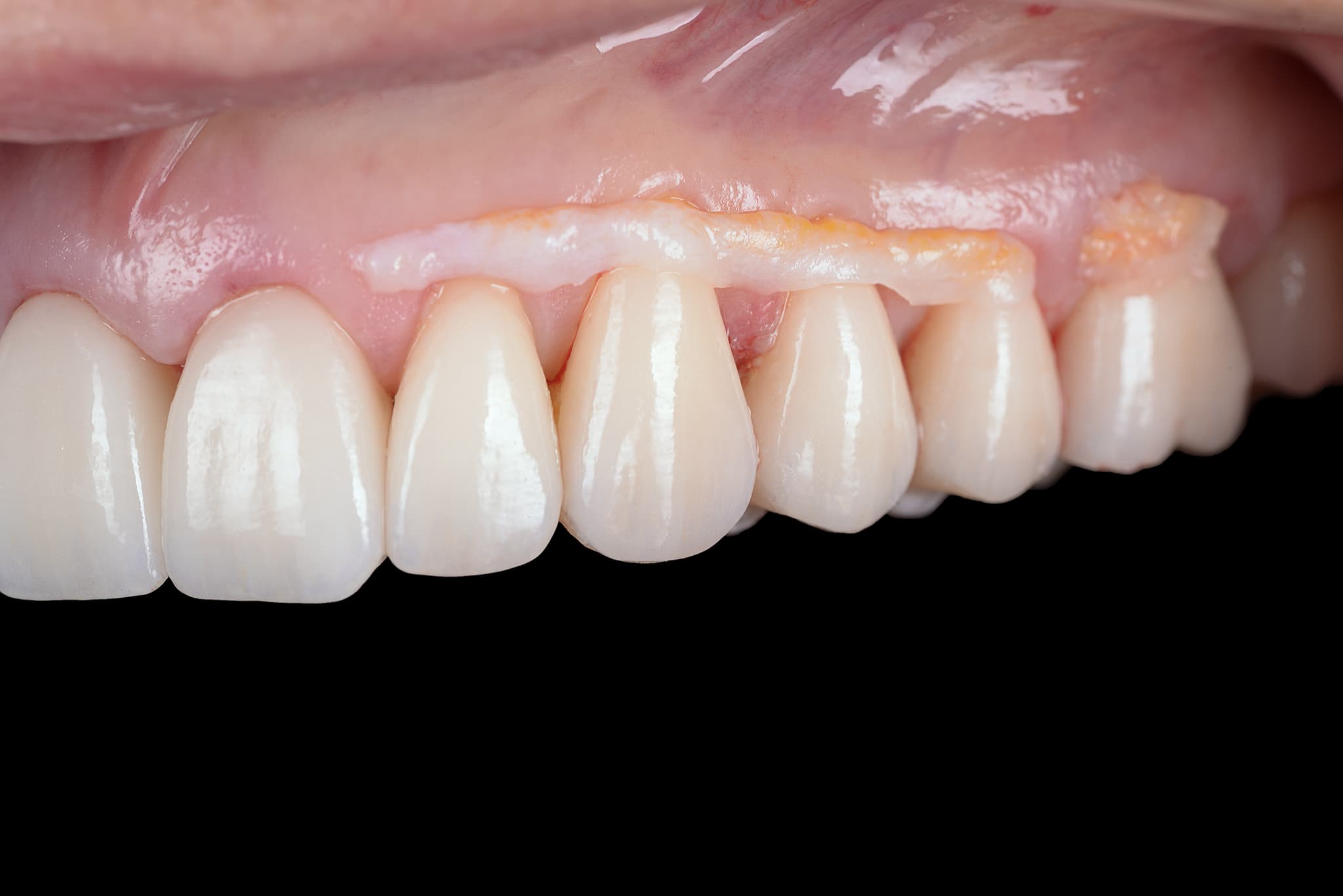 DCF_9653-1