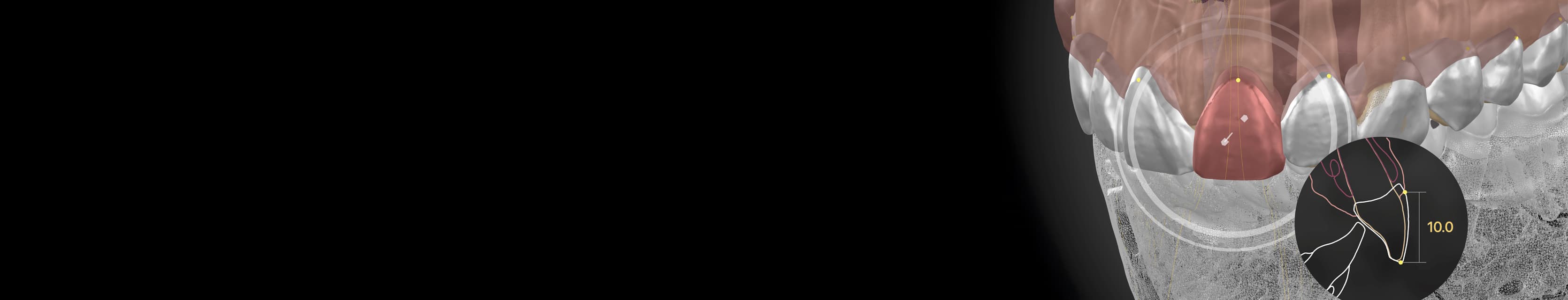 ID
