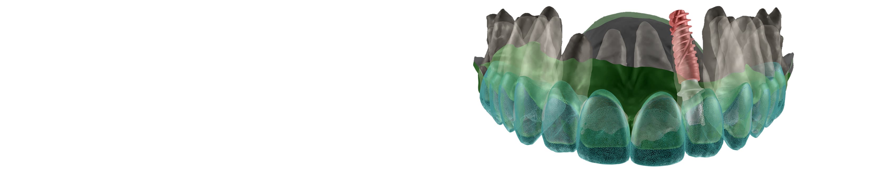 RAW: Surgical
