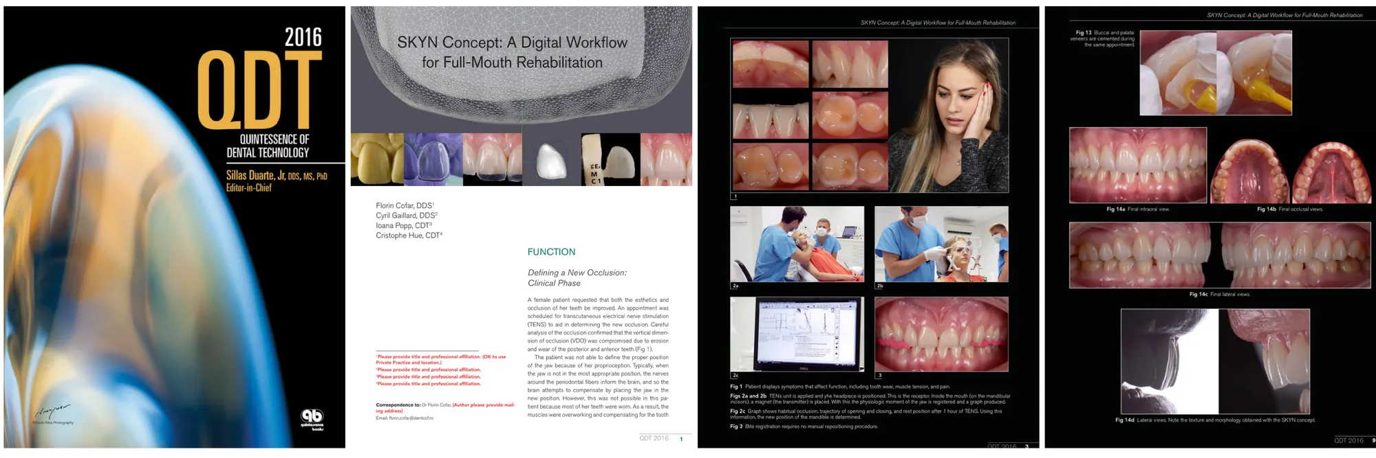 SKYN Concept: A Digital Workflow for Full-Mouth Rehabilitation