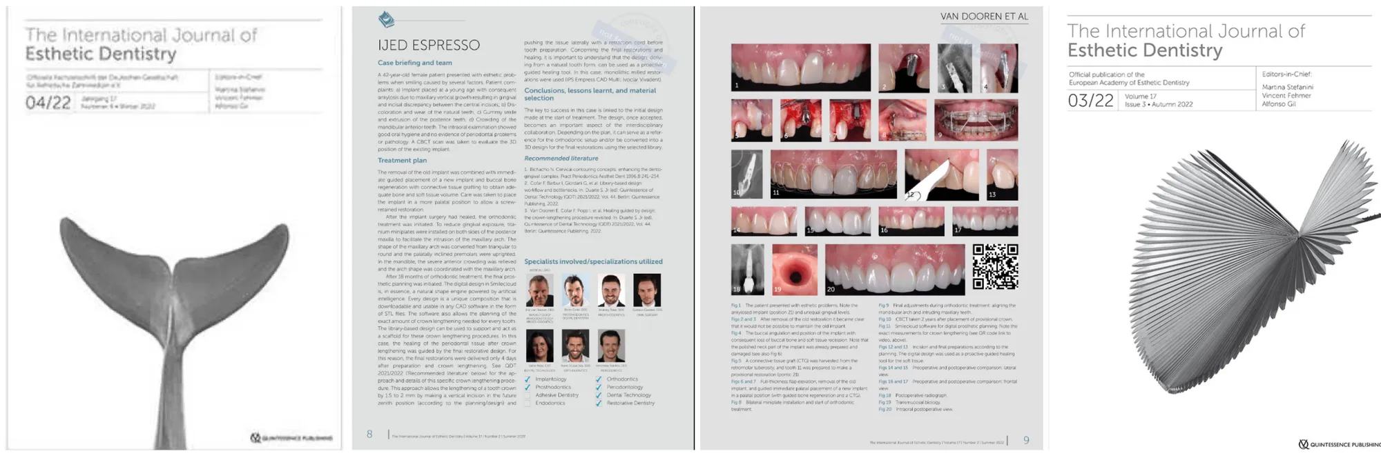 IJED Espresso – Esthetic Advances Overview