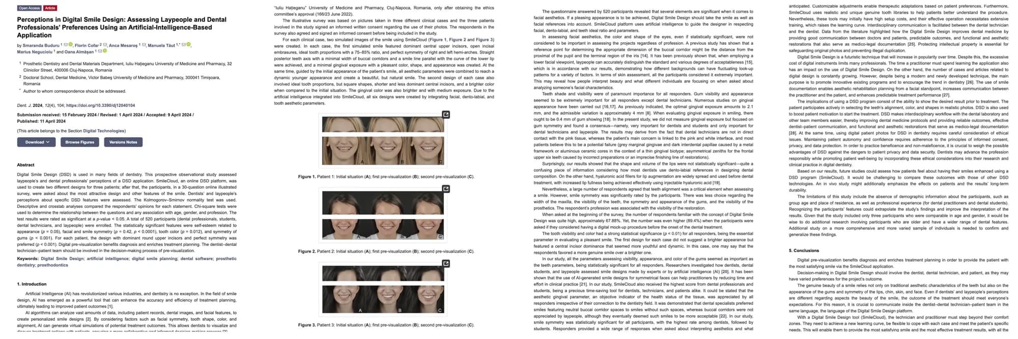 Perceptions in Digital Smile Design: Laypeople vs. Dental Professionals
