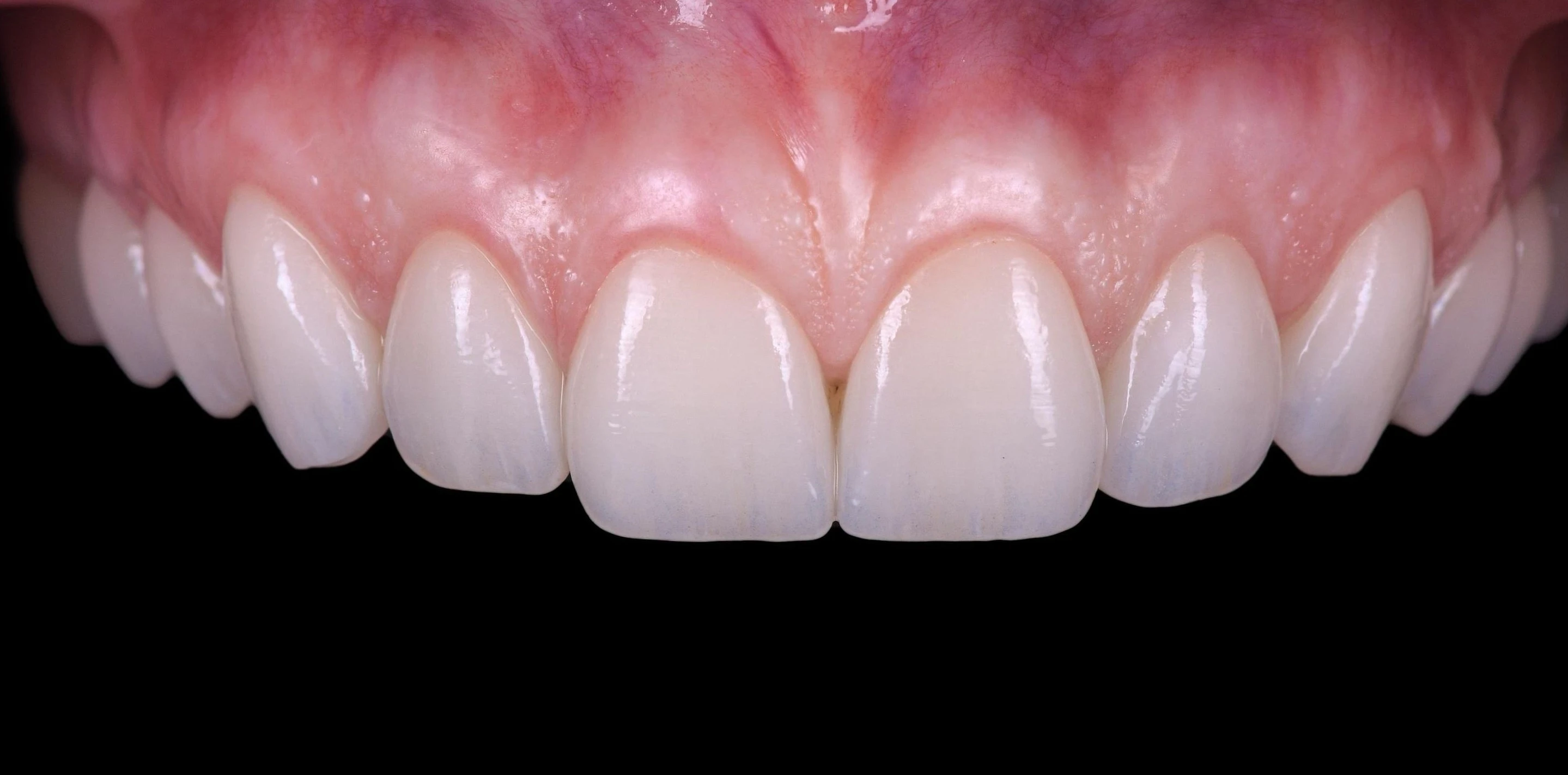 The final smile, close up