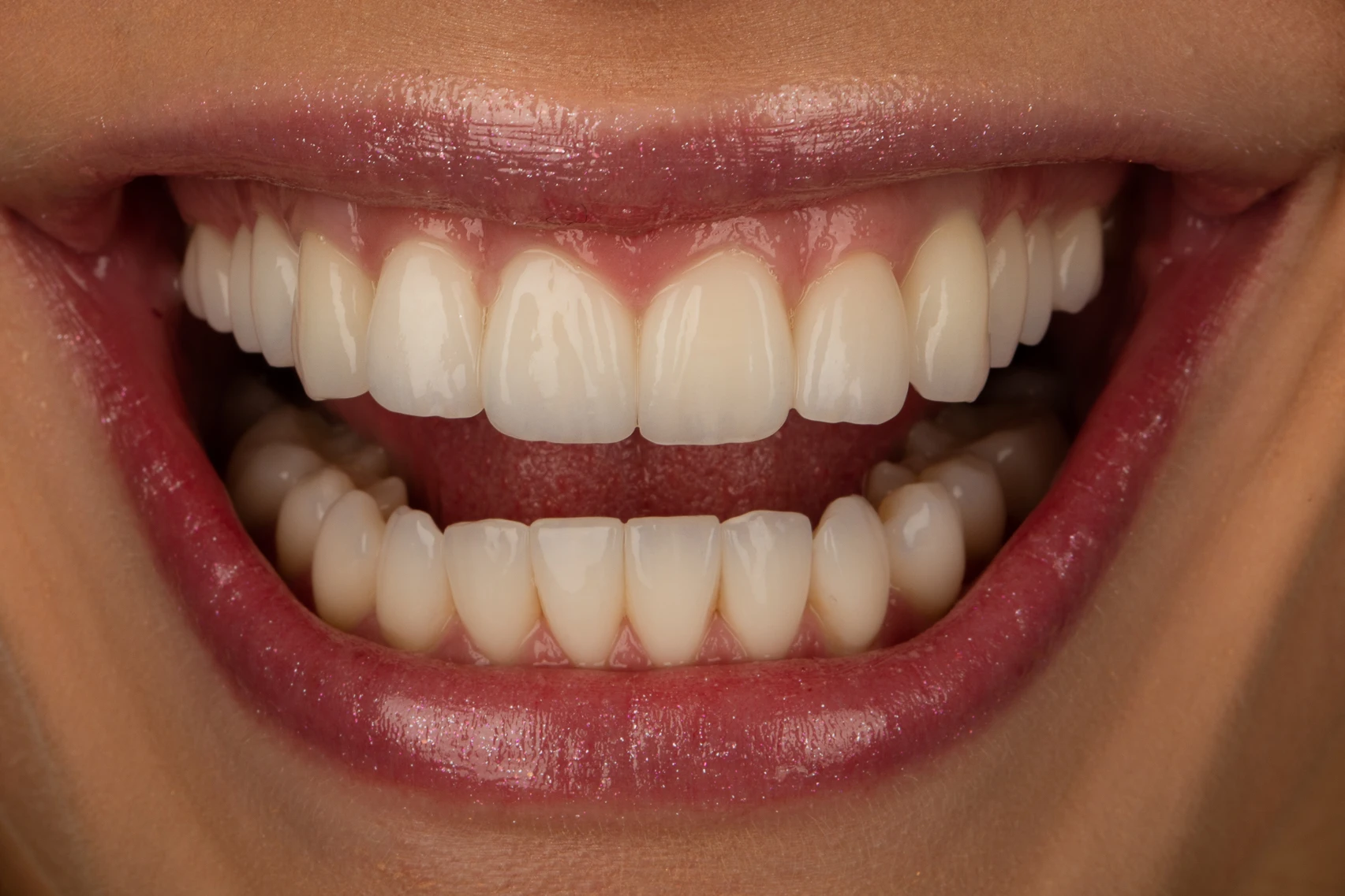 A woman's smile with natural tooth shapes