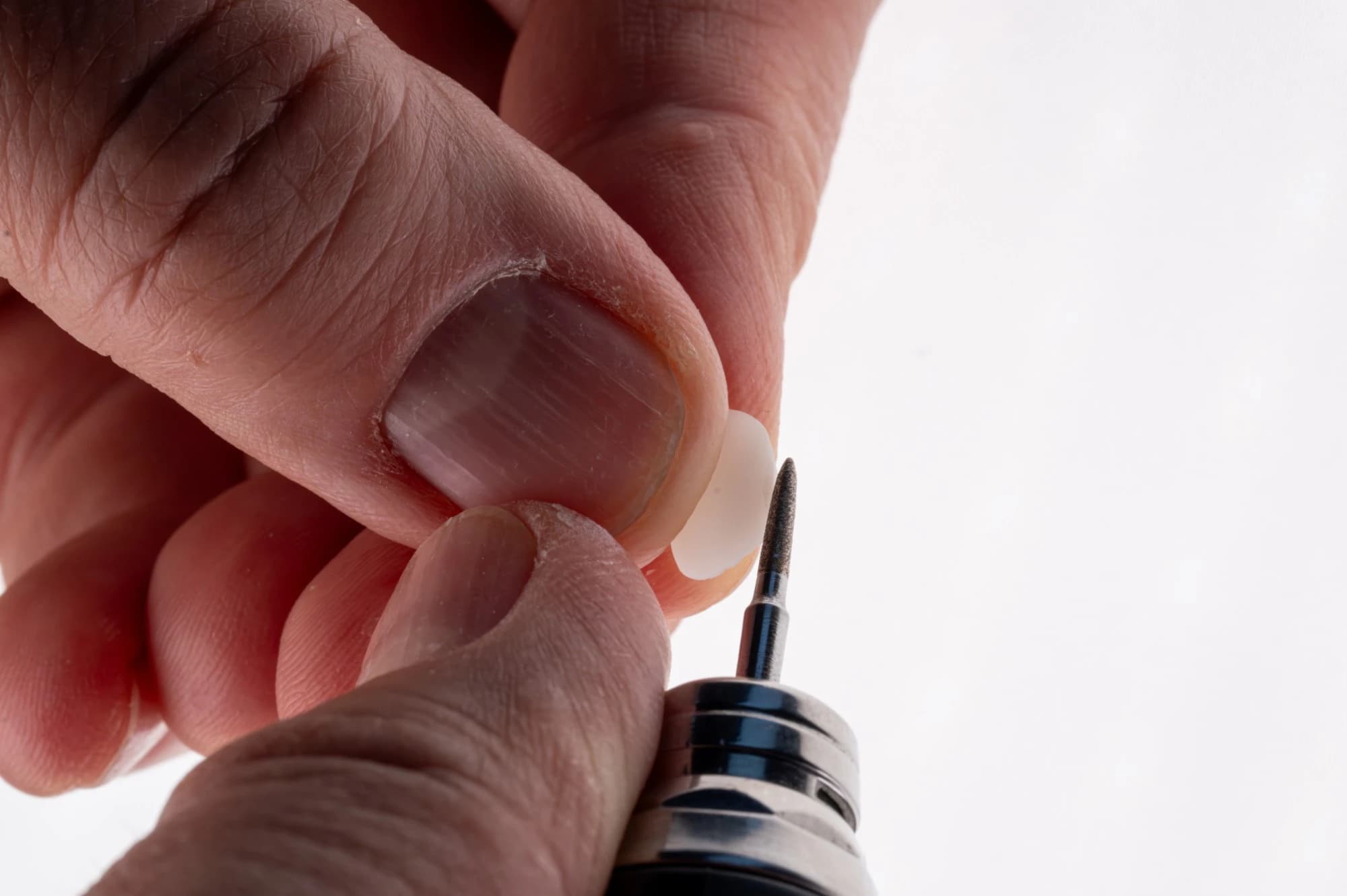 A technician finishing a ceramic veneer by hand