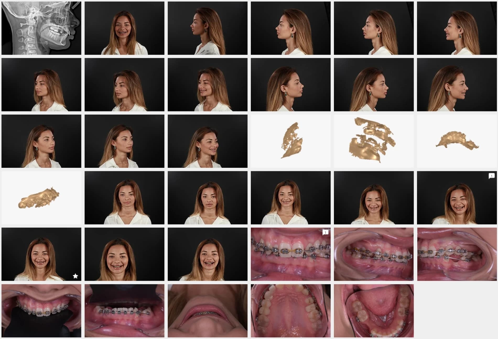 A patient’s records: face photos from every angle, a profile X-ray, 3D scans and close-ups of the teeth