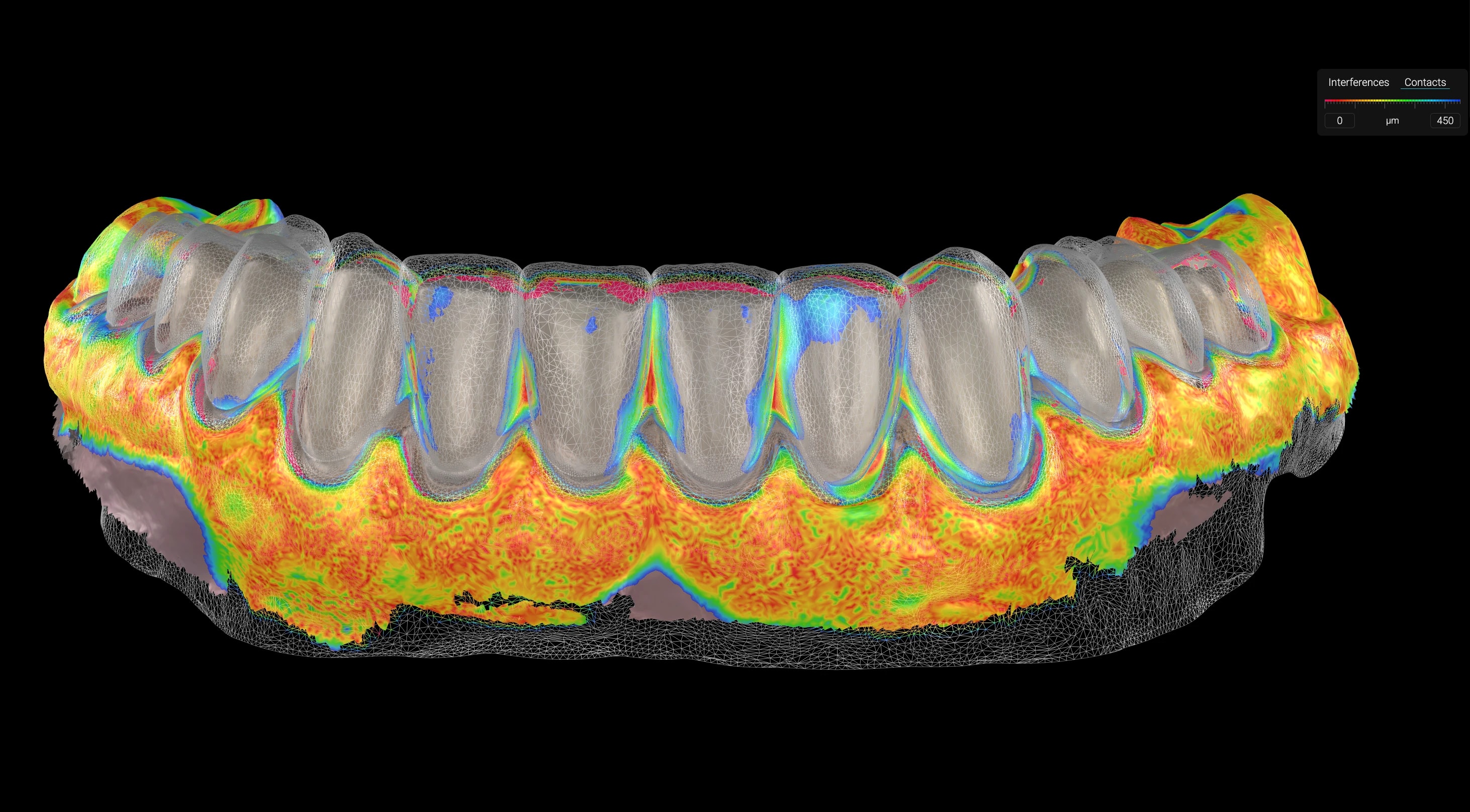 A heat map comparing the design with the current teeth