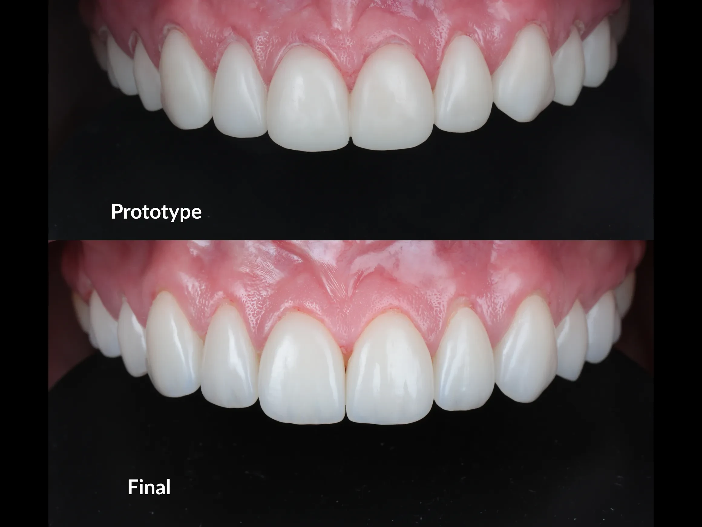The temporary prototype and the final restorations, compared