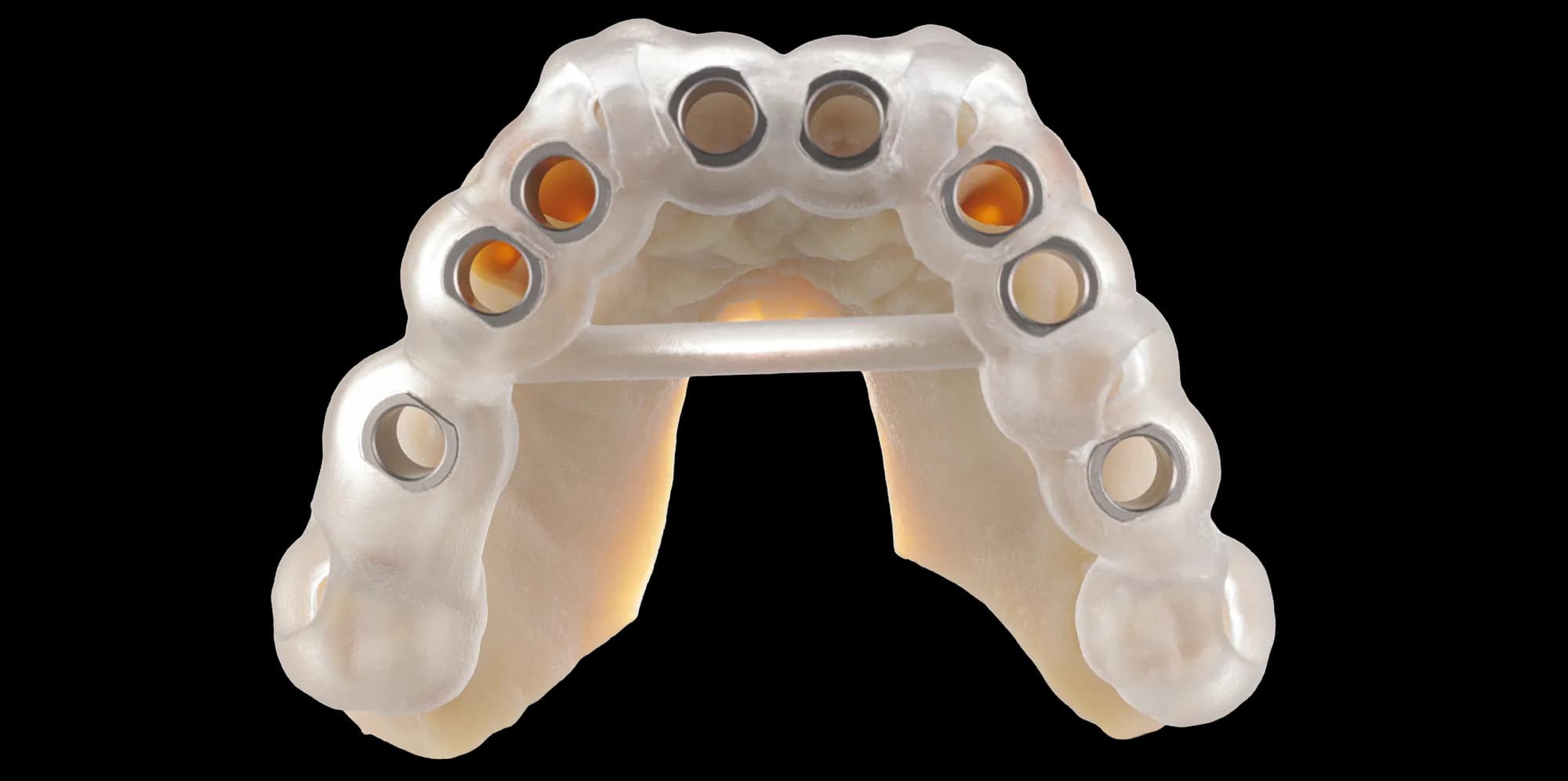 3D-printed surgical guide made from the design