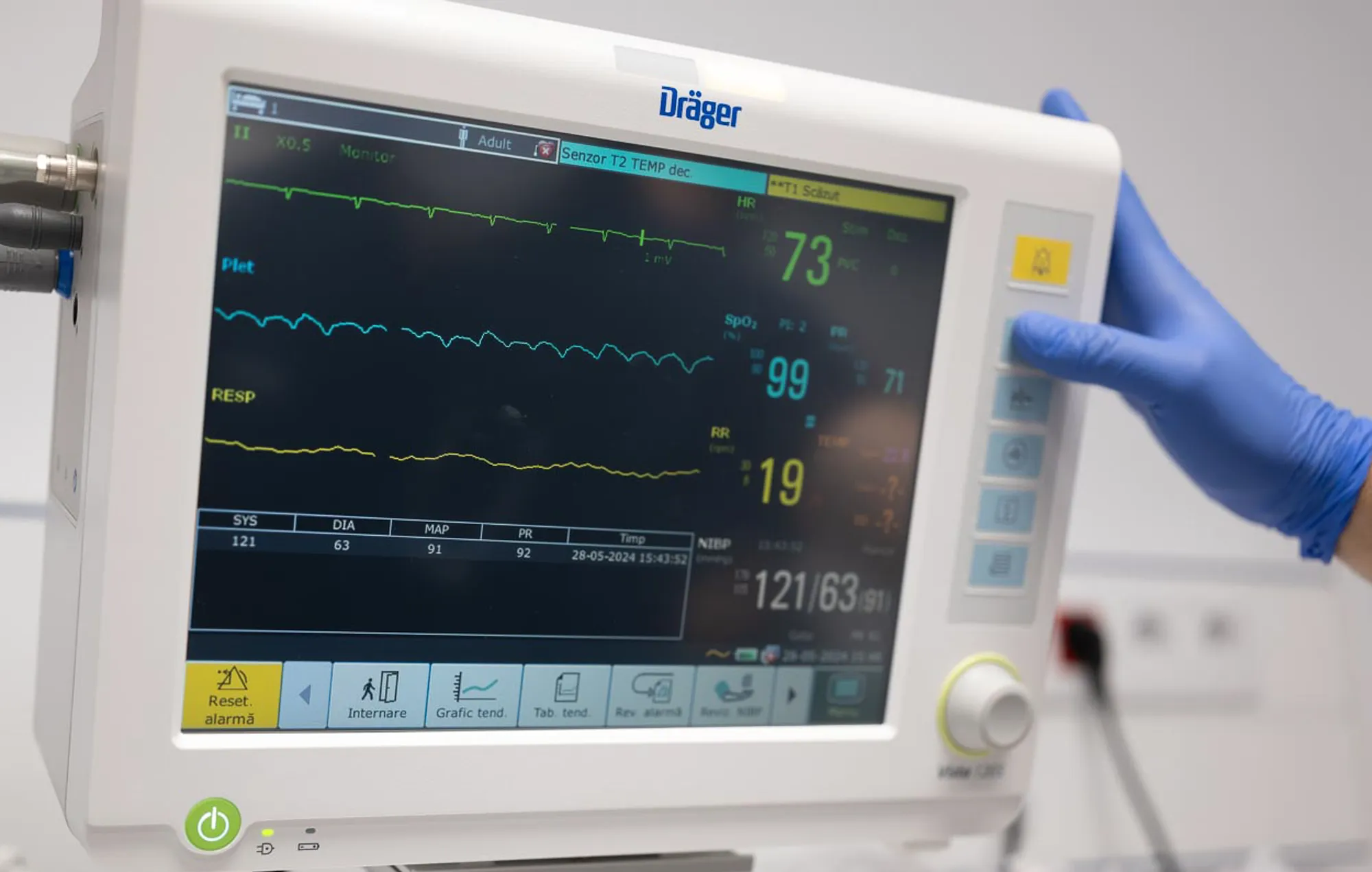 Patient monitor showing vital signs