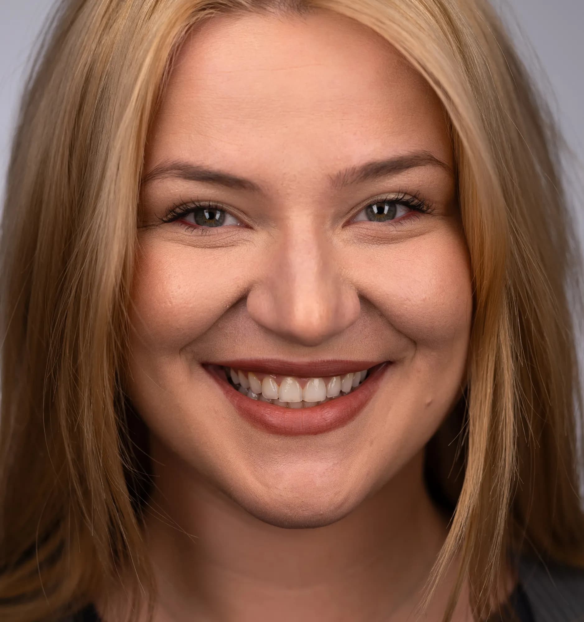 Jaw surgery and orthodontics, almost no restorations