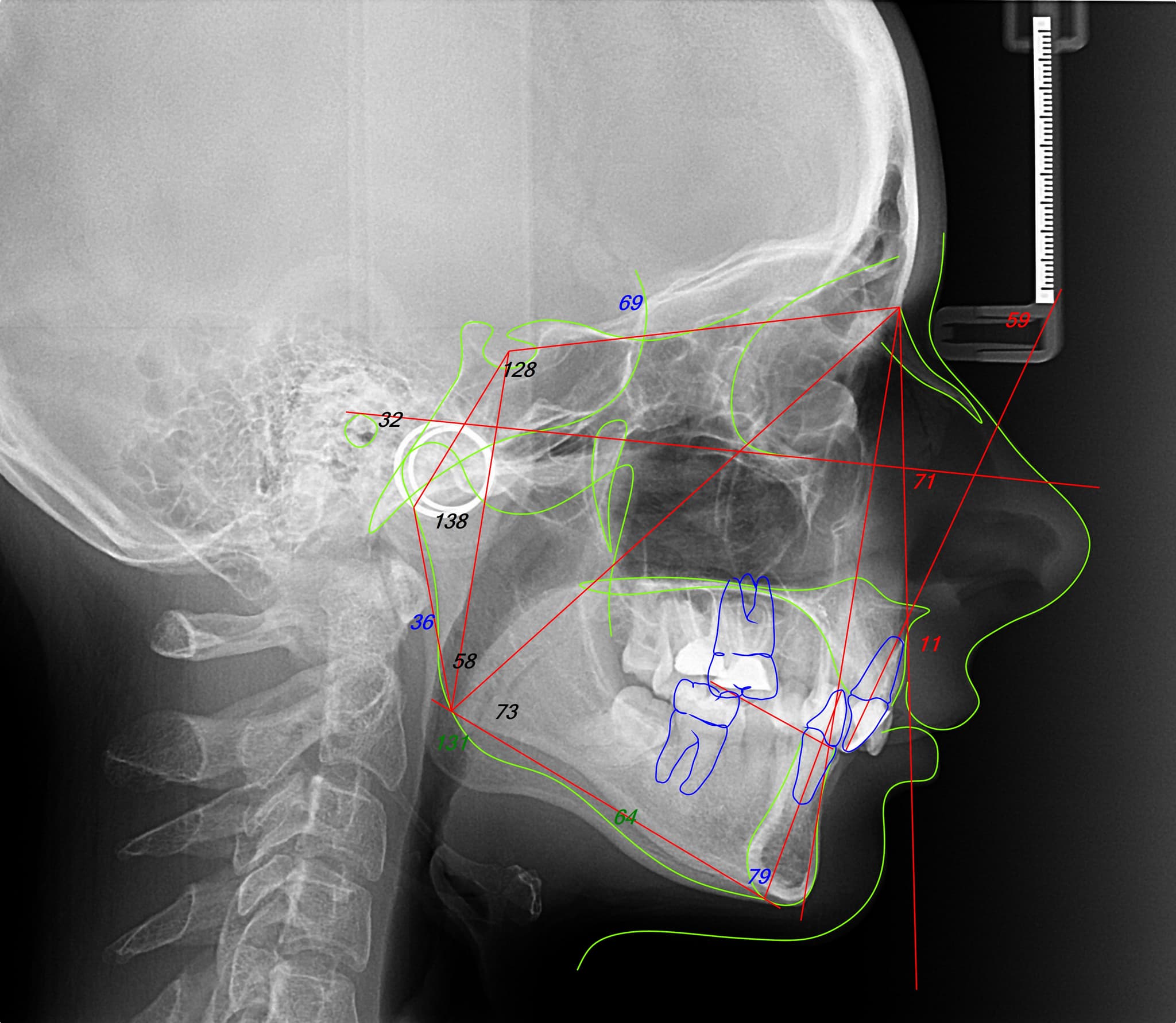 meas rx INITIAL