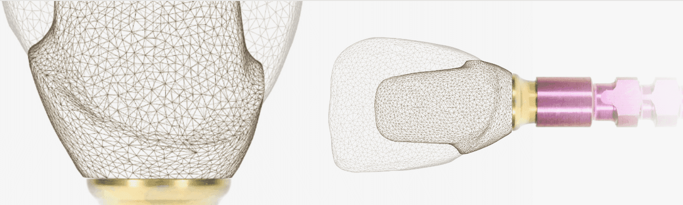 implants_digital_white