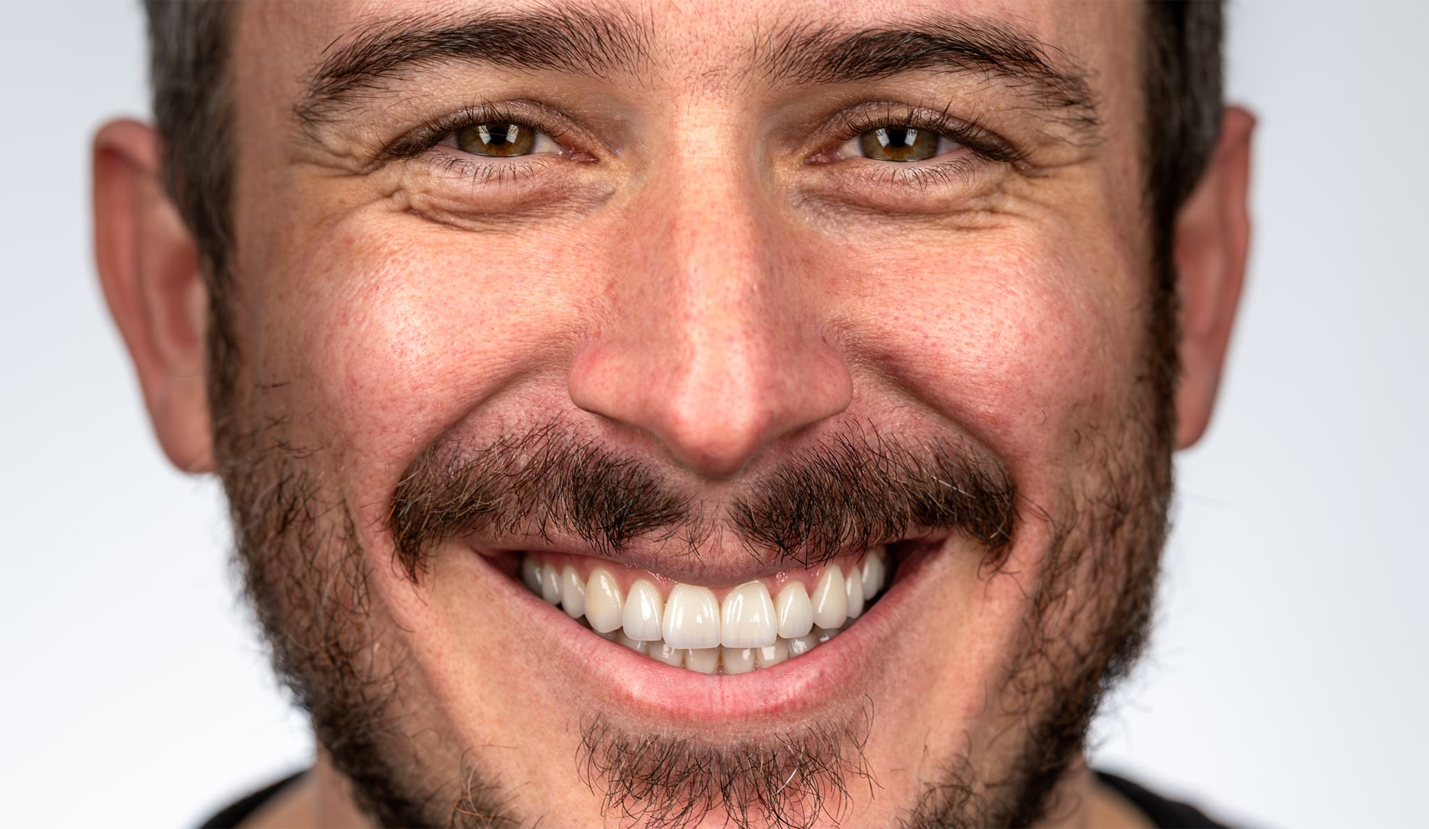 L1000797-Enhanced-NR-3-2