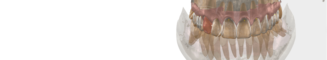 Smilecloud Blueprint – Singular Design for Interdisciplinary Dentistry