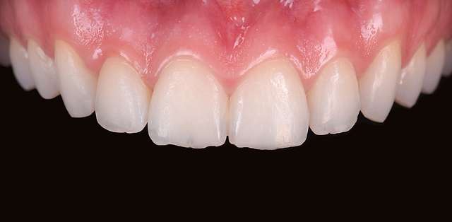 cosmetic-dentistry