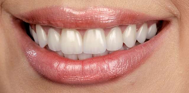 natural-dental-crowns