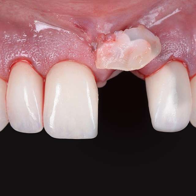 periodontal-treatment