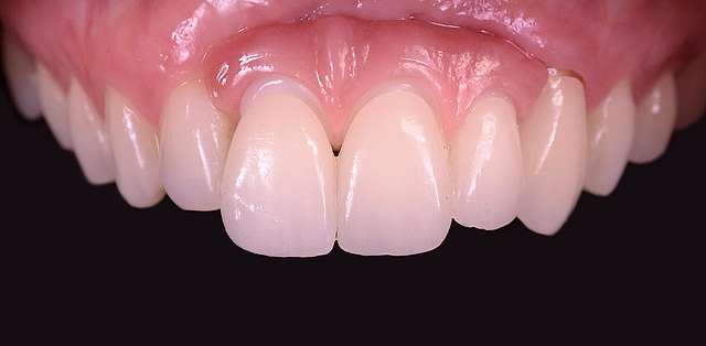 teeth-05