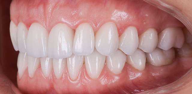 teeth-08