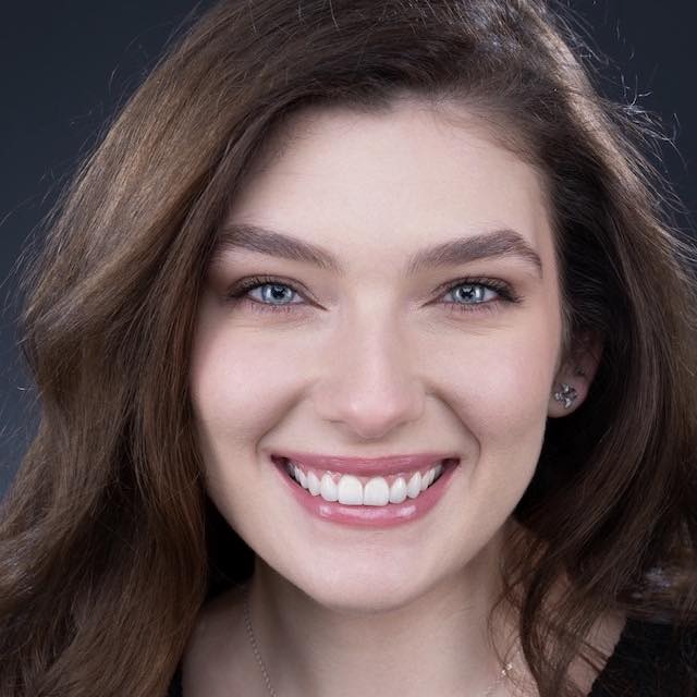 after-smile-design