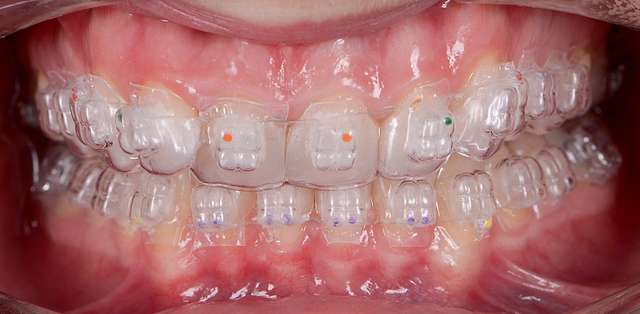 teeth-7