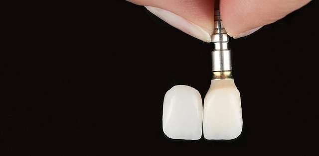 teeth-6
