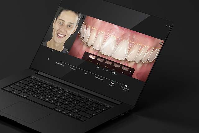 teeth-02