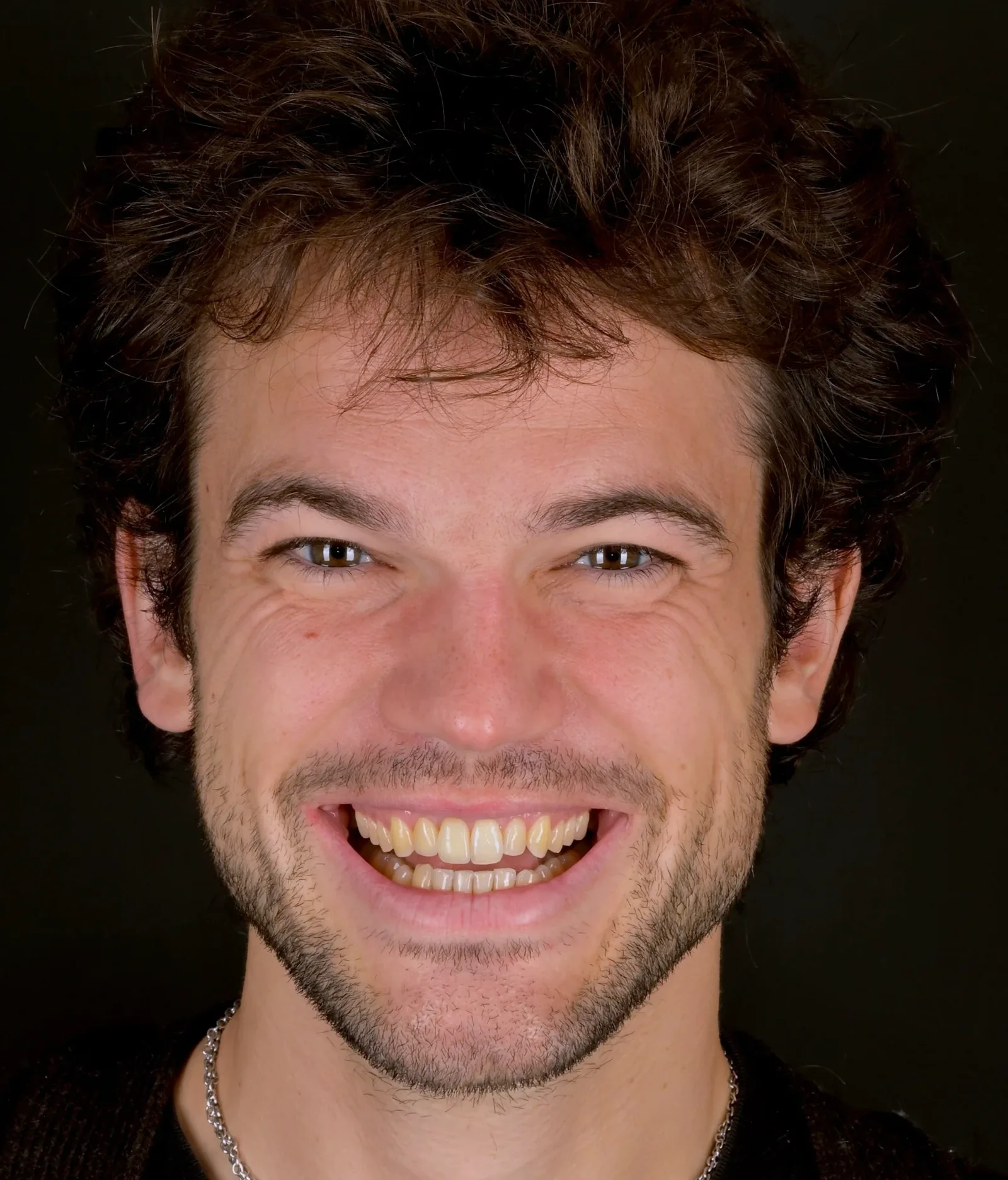 The patient's final result after treatment