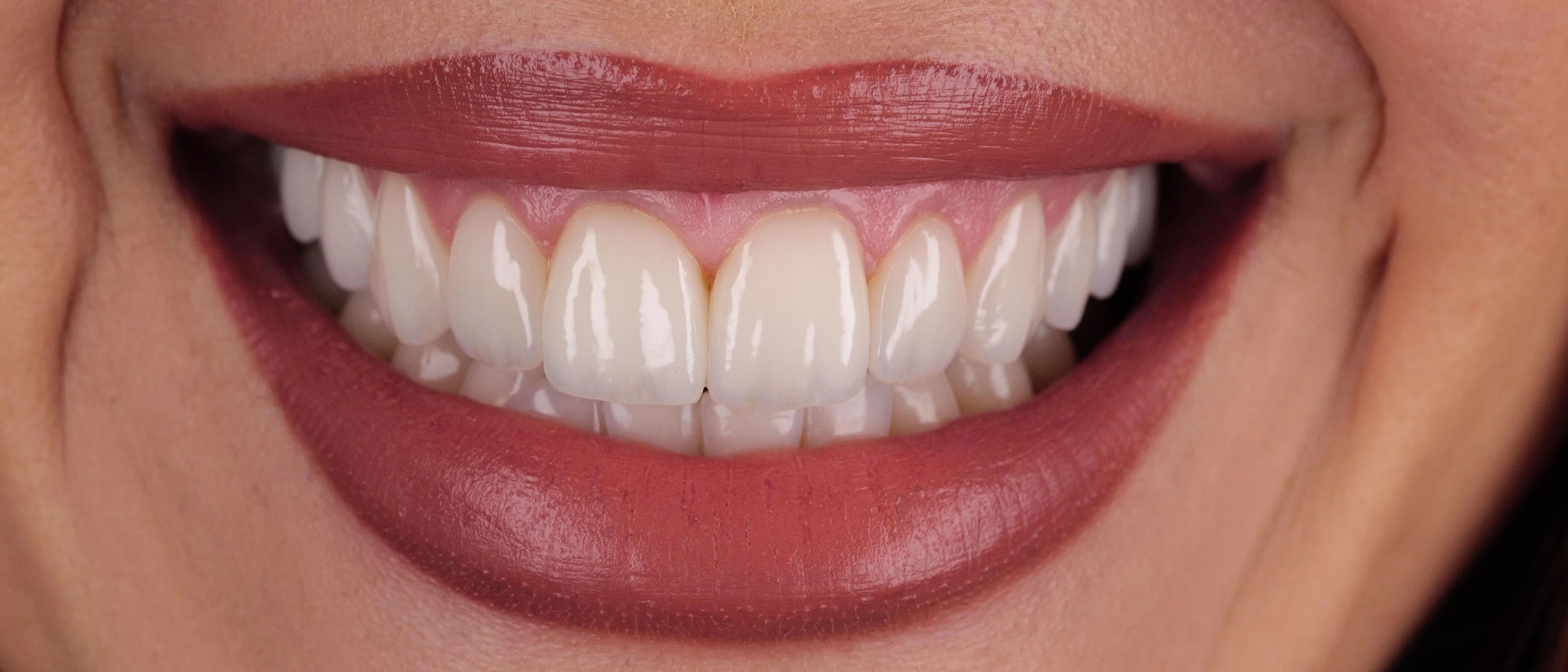 The final smile, close up