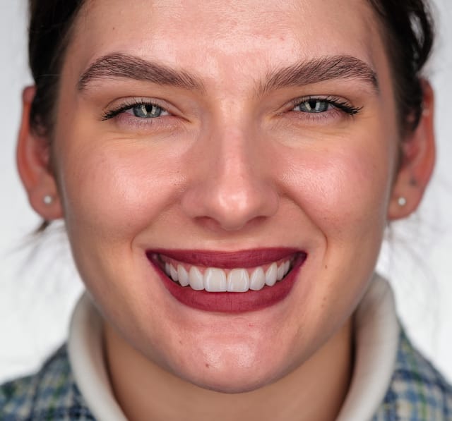 Portret final, expresie relaxată cu zâmbet restaurat