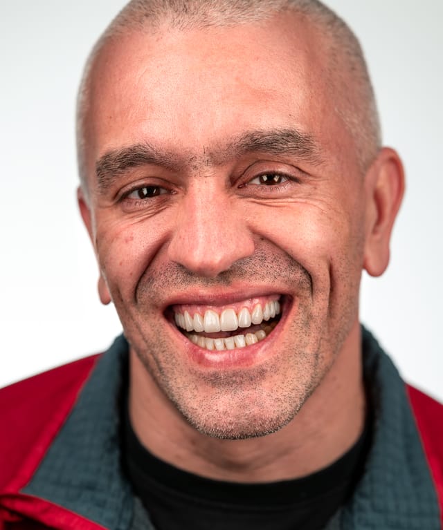 Post-rehabilitation portrait showing improved vertical dimension and natural tooth display