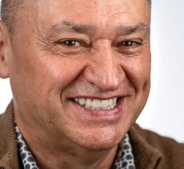 Macro image showing monolithic restorations on implants and natural teeth, with functional surface detail and soft tissue harmony.