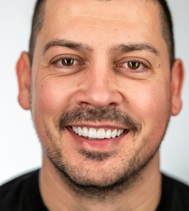 Portret final cu zâmbet complet după tratament ortodontic și restaurativ