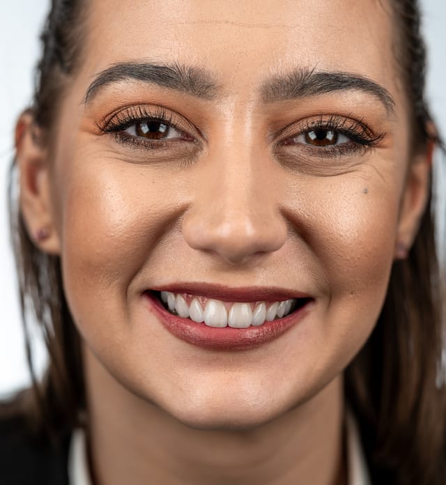 Integration of crowns, veneers, and soft tissue contours across edentulous zones.