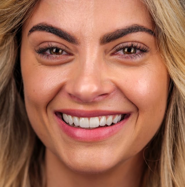 Frontal image showing balanced smile proportions and natural character preserved through subtle design.