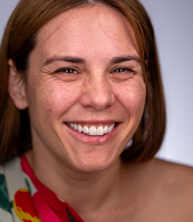 Angled view capturing seamless integration of implant-supported teeth and natural dentition following space closure.