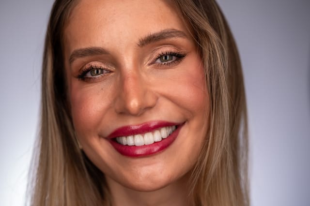 Smile showing balanced gingival contours and seamless integration of implant-supported restorations.